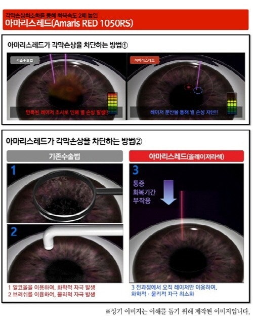 레드김 이미지