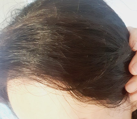 헤어엔미량 이미지