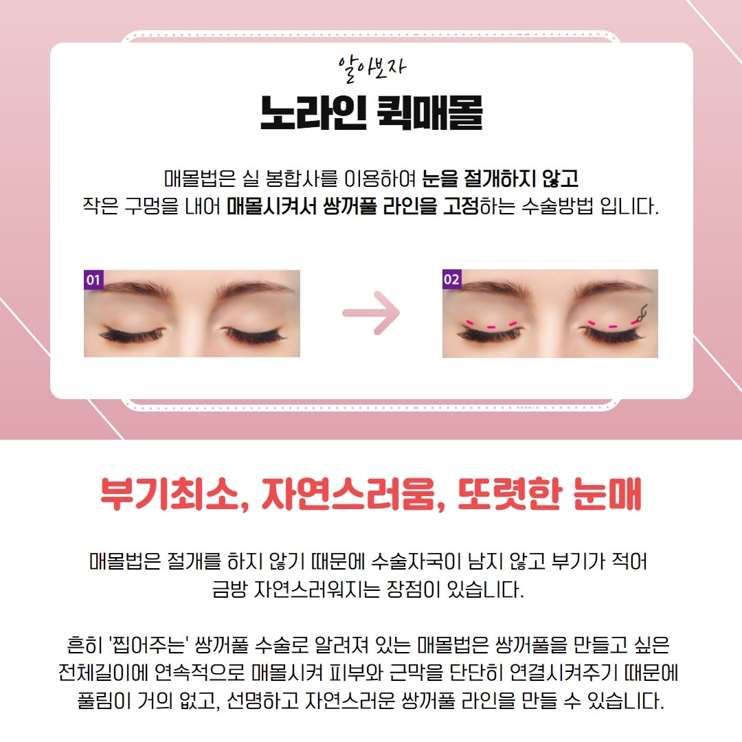 뉴니스디자인 이미지