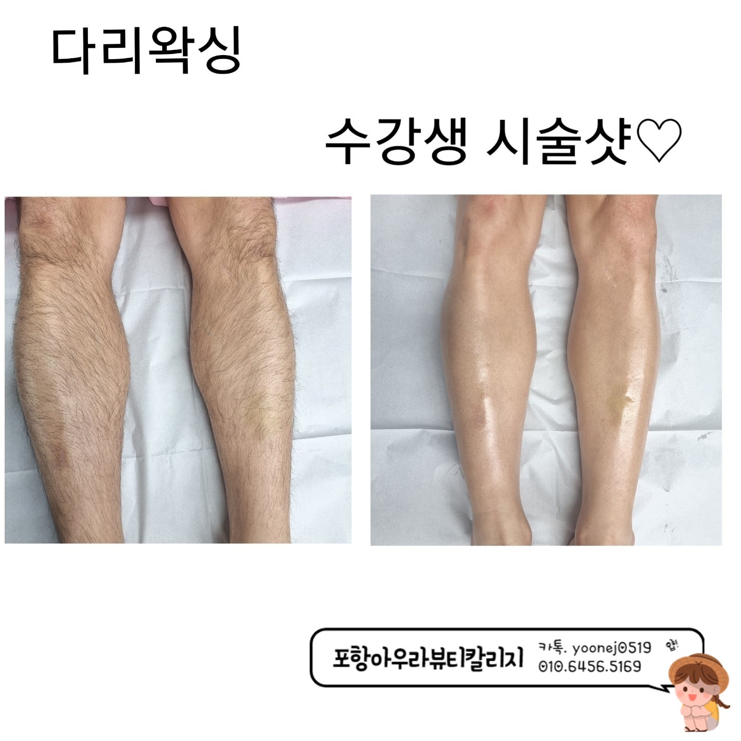 아우라왁싱 이미지