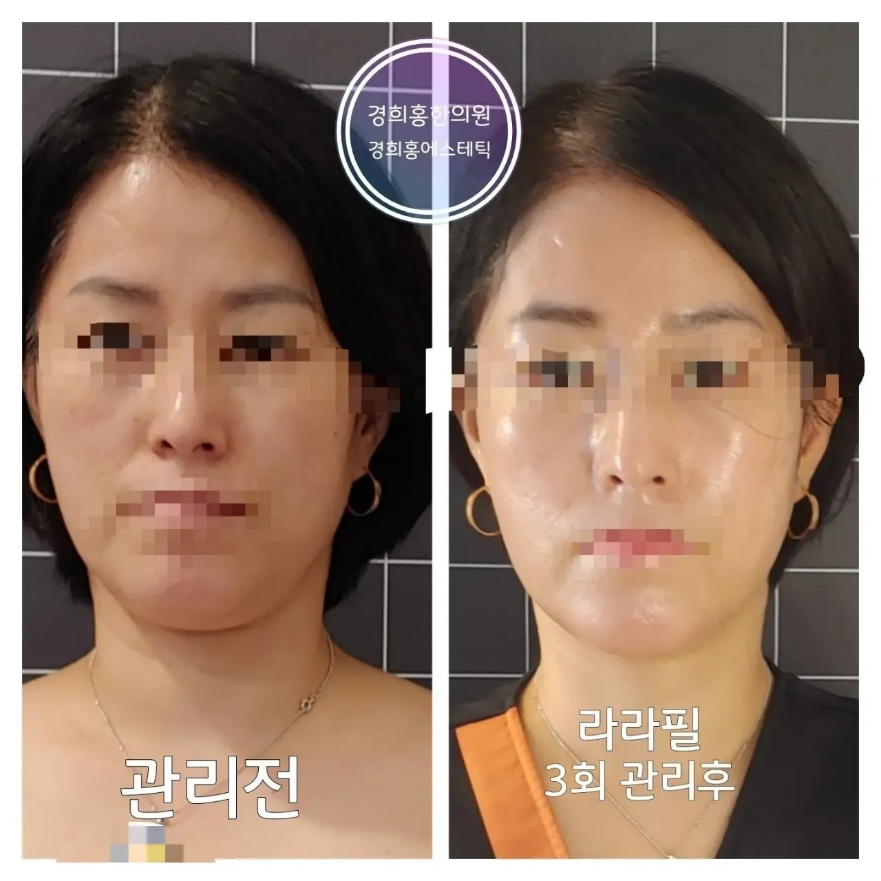 경희필한의원 이미지