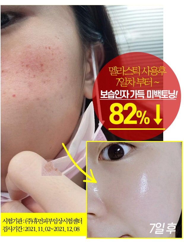 스틱톡스 이미지