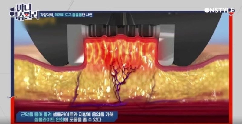 모델라지 이미지