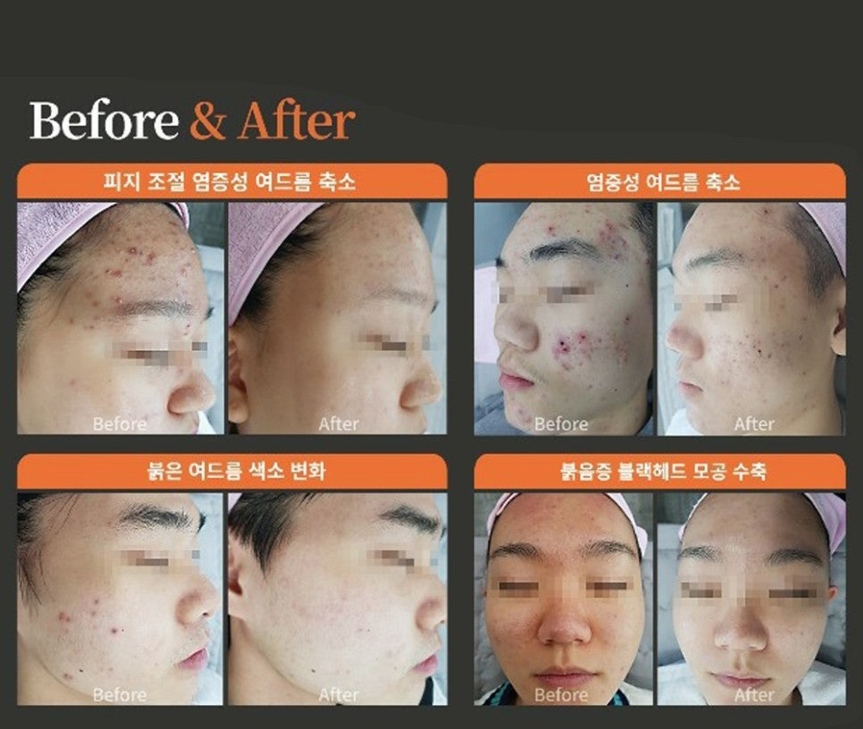 라벨테라피 이미지