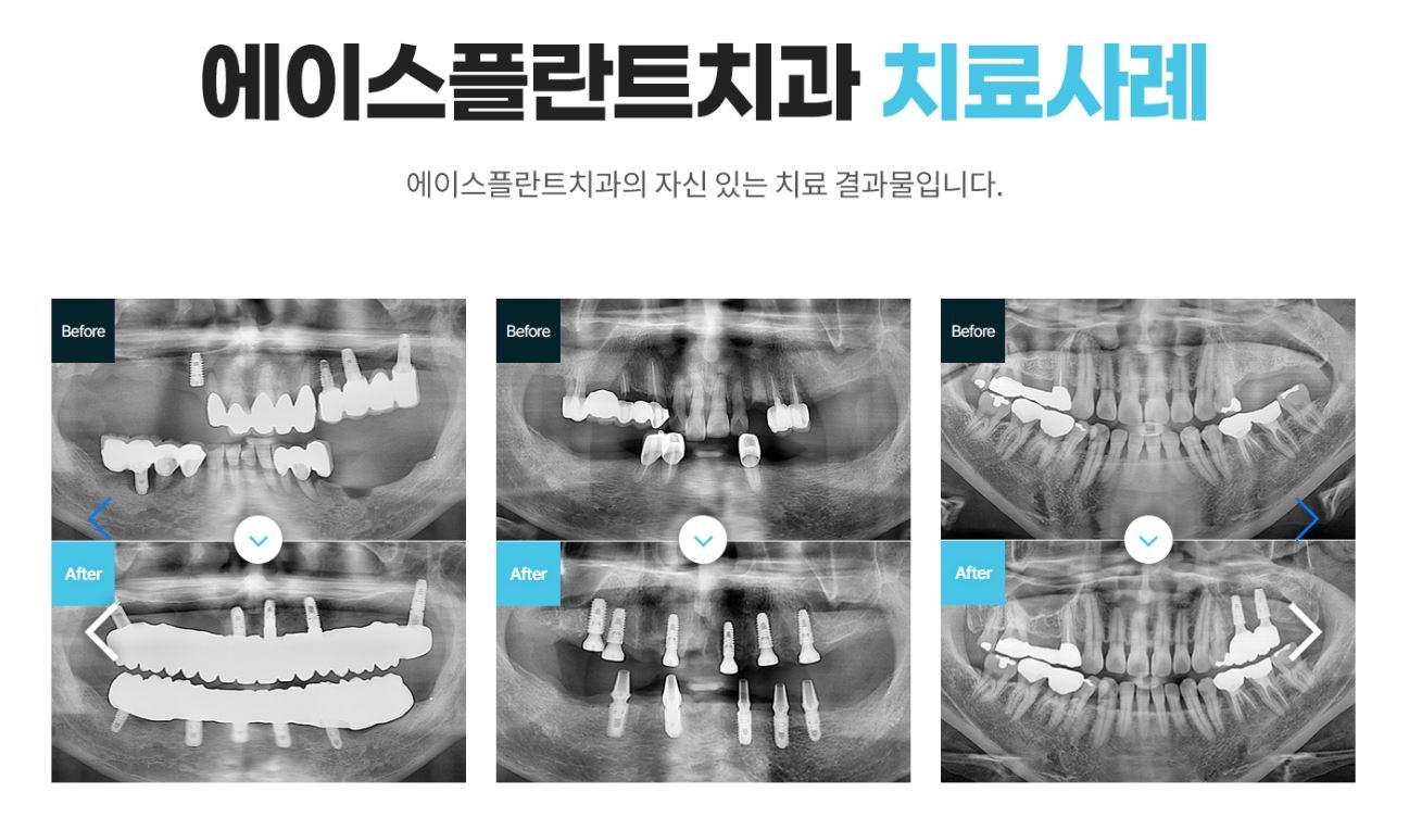 해드림치과 이미지