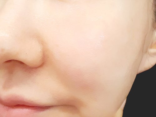 노벨젠메드 이미지