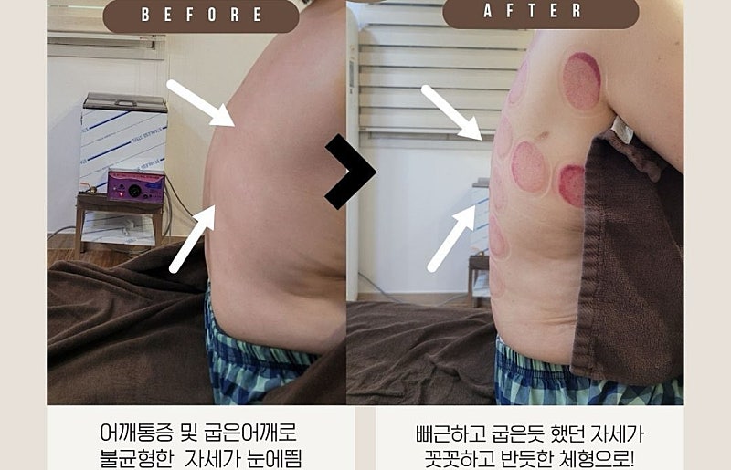 뀨니뷰티 이미지