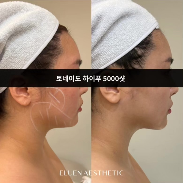 루엔에스테틱 이미지