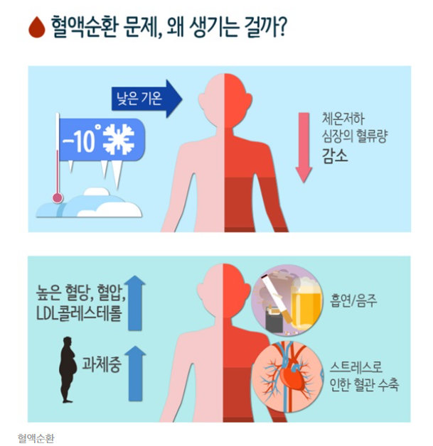 혈액순환이 안되면 일어나는 현상들... 혈액순환이 안되면 일어나는 현상들...