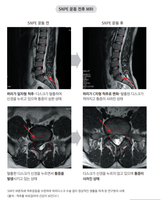 바른자세바디케어운동센터 이미지