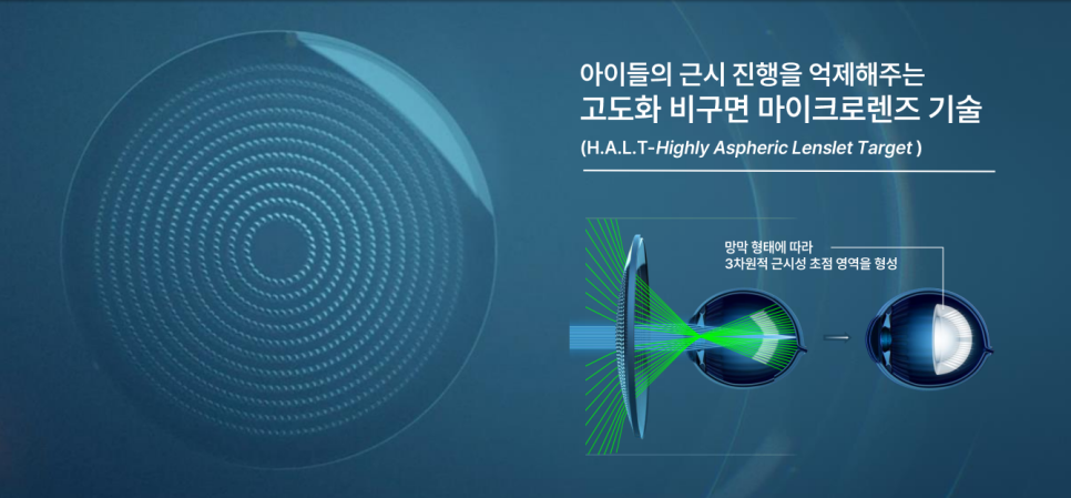 아이들리스트 이미지