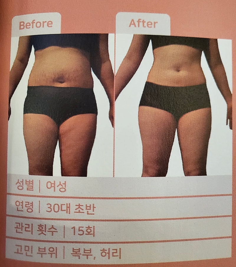 모델라지 이미지