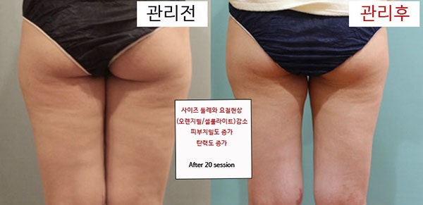 모델라지 이미지